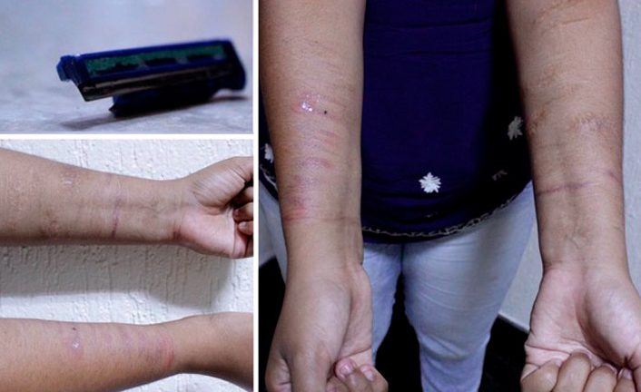 mutilacao-1-706×432