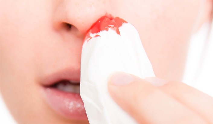 narizsangrando-706×410