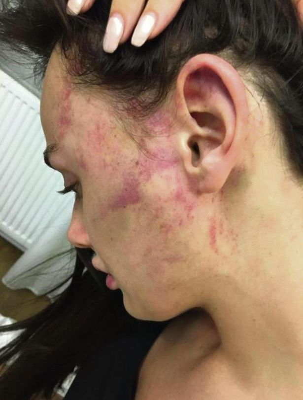 violência contra mulher