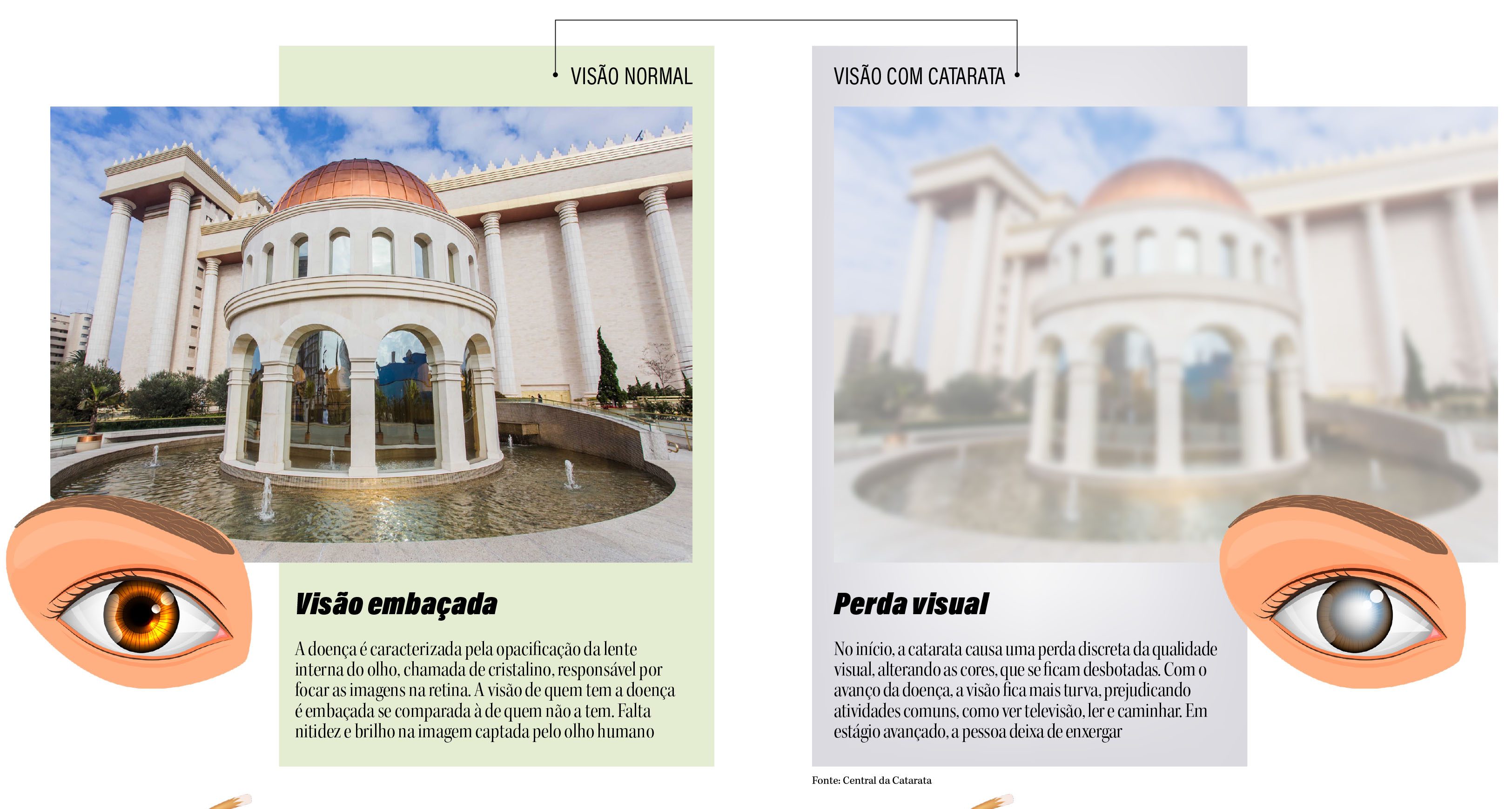 Arte_1423 Visão embaçada