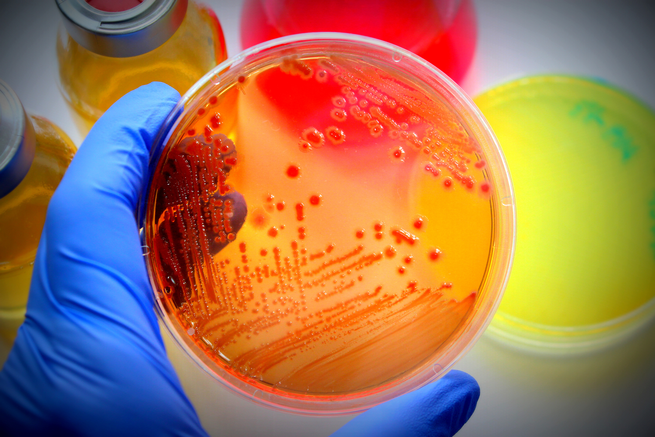 Imagem de capa - “Superbactérias” poderão matar mais de 10 milhões em 2050