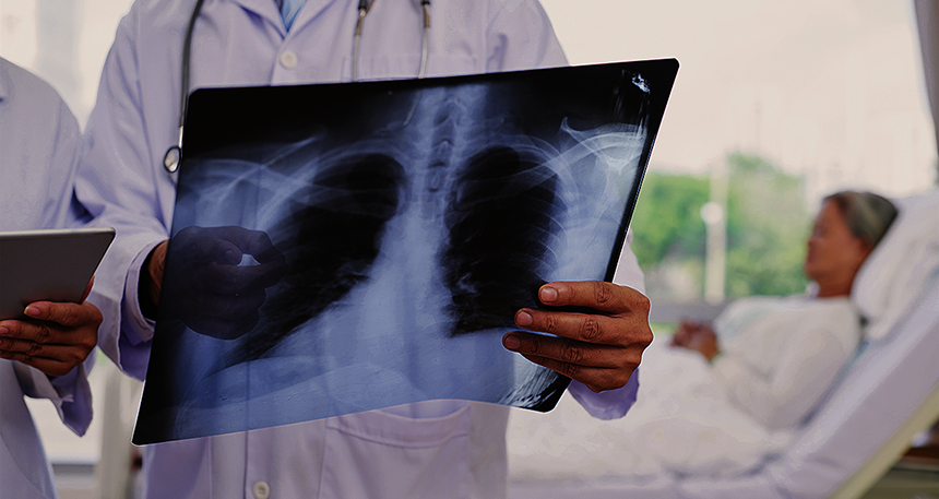 Imagem de capa - Pneumonia é coisa séria