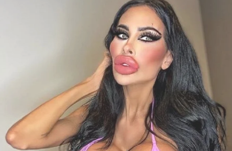 Imagem de capa - Falta acesso à coleta de esgoto para 100 milhões de brasileiros