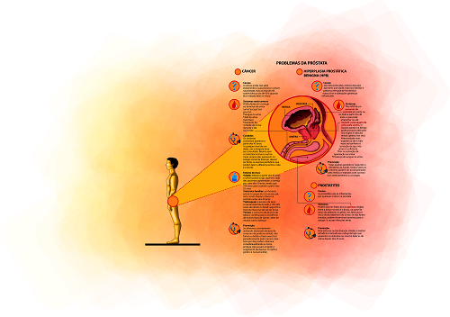 Imagem de capa - Doenças da próstata: mortes dobram em dez anos