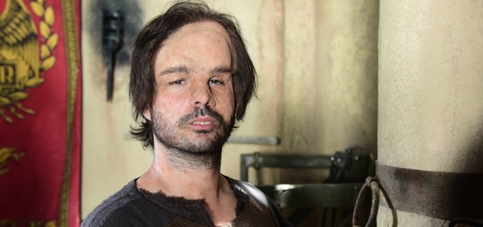 Hidrópico1_Novela Jesus