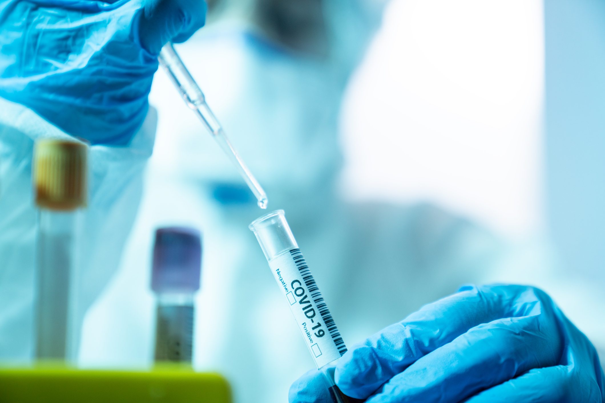 Scientist Woman Working In The CDC Laboratory For Covid-19