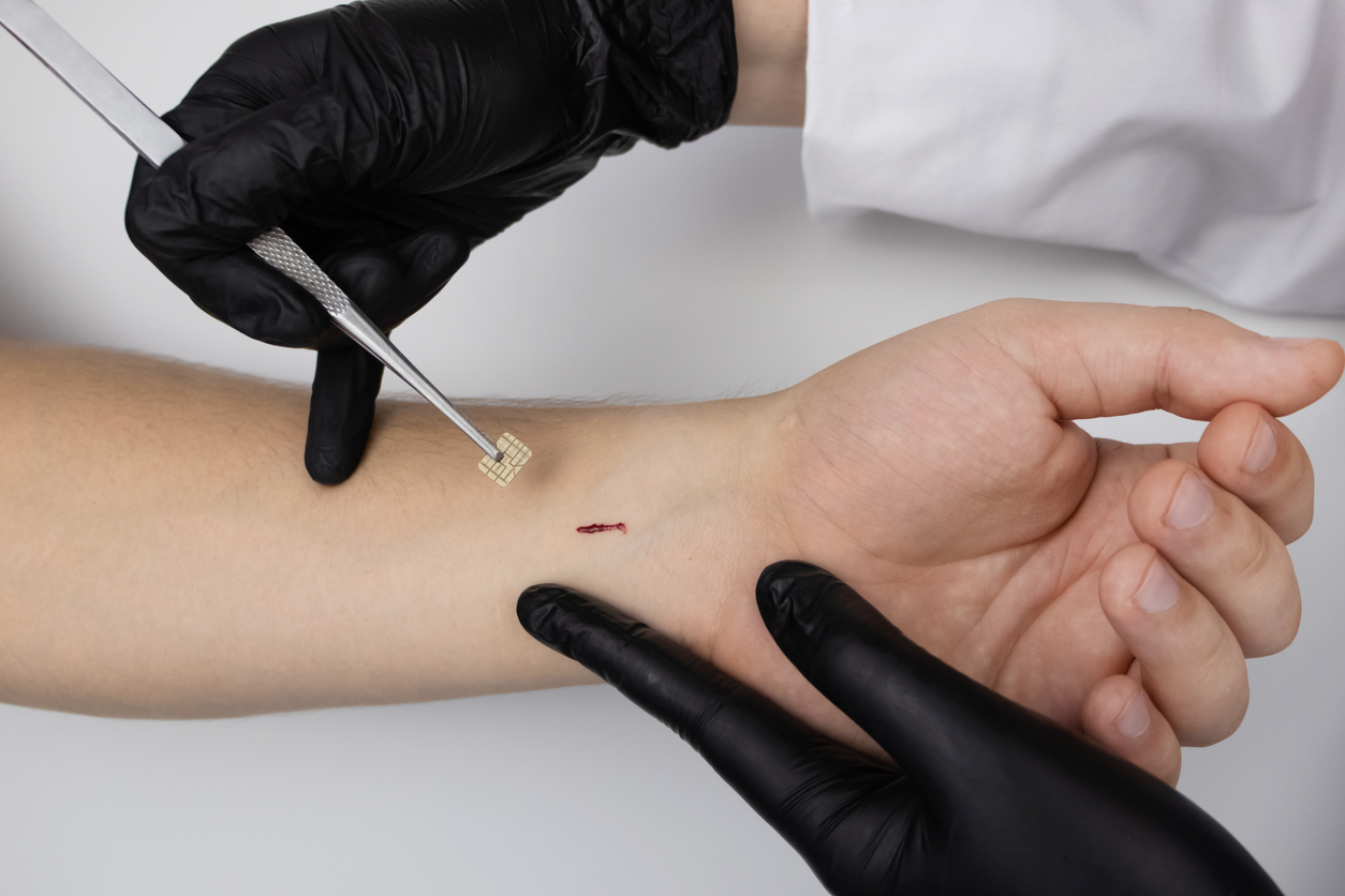 Imagem de capa - Passaporte vacinal em microchip sob a pele: &#8220;praticidade&#8221; ou profecia se cumprindo?