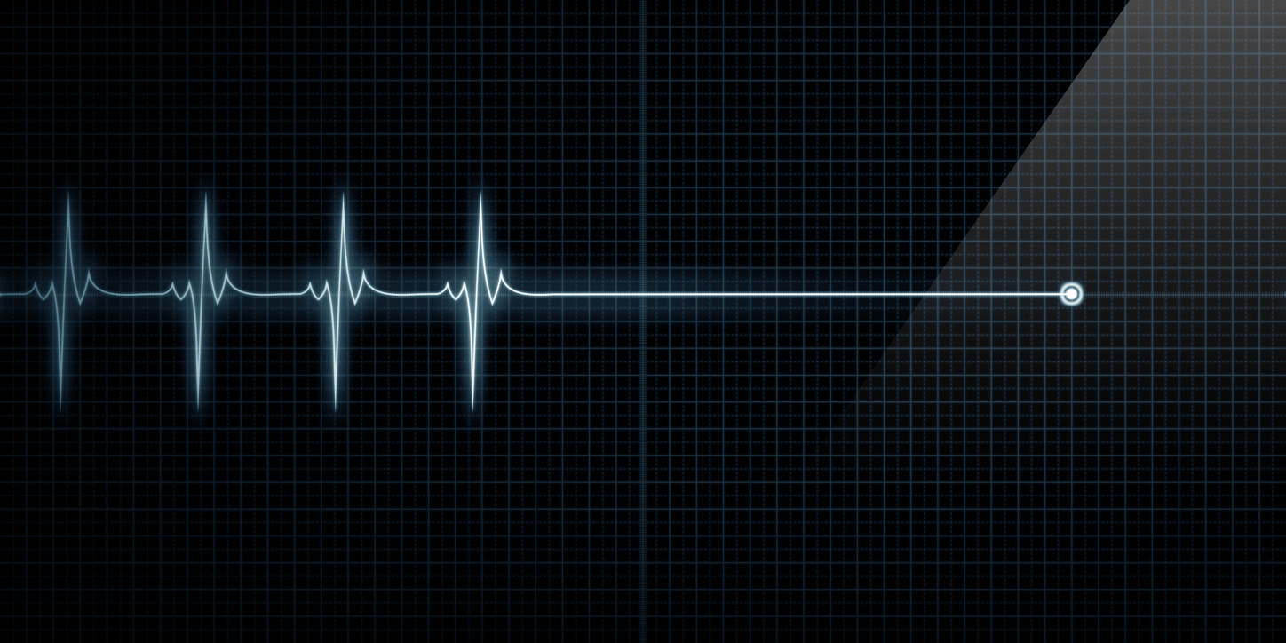 Heart Monitor Flat Line Death
