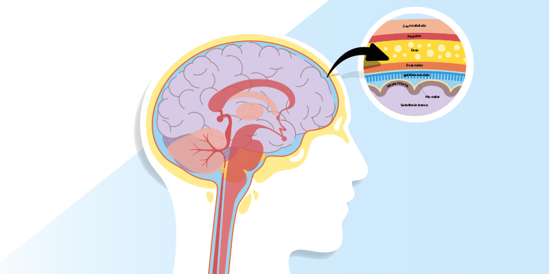 Imagem de capa - Como manter a meningite distante