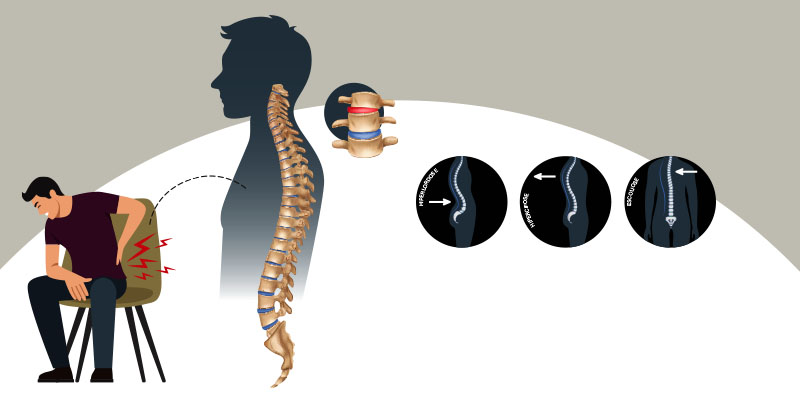 Imagem de capa - Por dentro dos problemas posturais