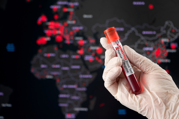 postÁfrica registra quase 30 mil casos de mpoxna categoriaApenas em 2024