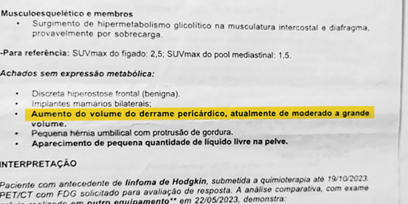 Um câncer e um derrame pericárdico