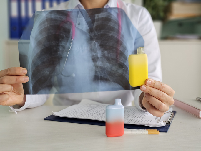 postCigarro eletrônico: adolescente morre por complicações pulmonaresna categoriaComportamento postCigarro eletrônico: adolescente morre por complicações pulmonaresna categoriaComportamento