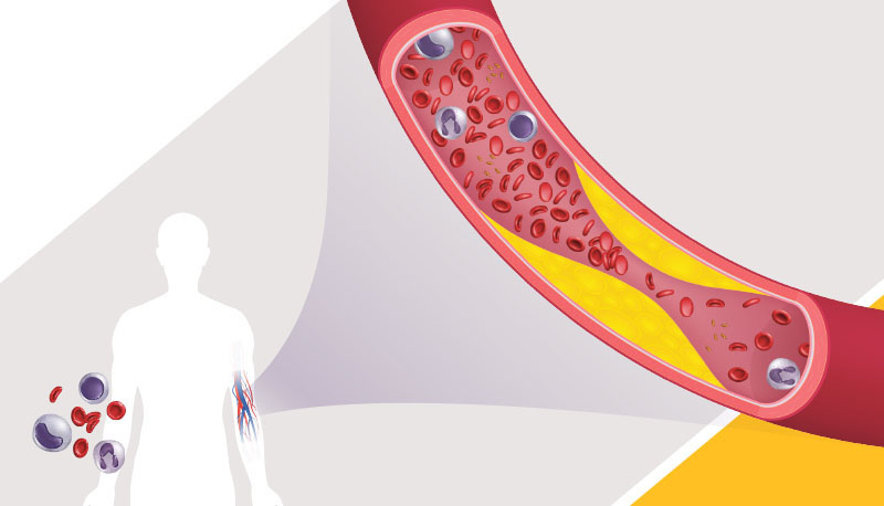 Imagem de capa - Colesterol é herói ou vilão?