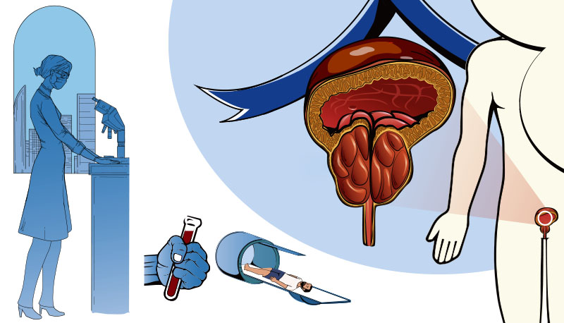 Mude a sua visão sobre o exame que pode salvar a sua vida