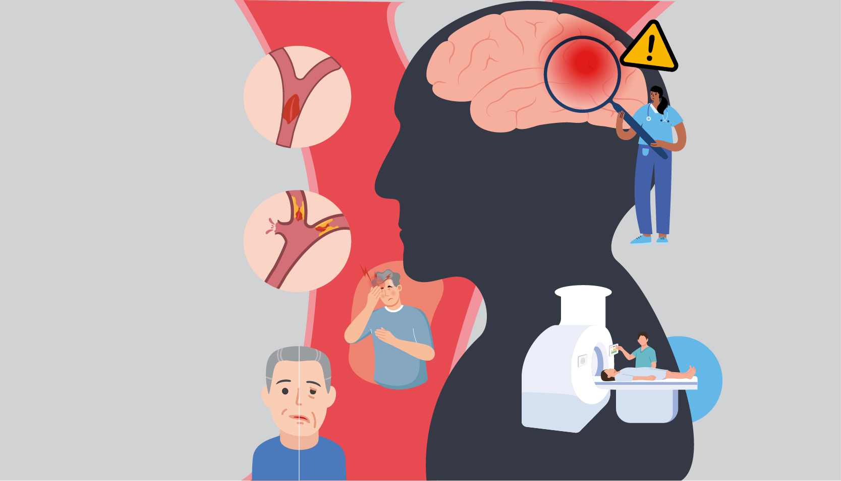 postAVC: uma ameaça conhecida, mas ainda subestimadana categoriaFolha Informa